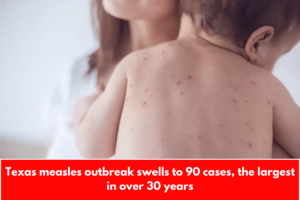 Texas measles outbreak swells to 90 cases, the largest in over 30 years